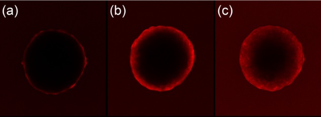 breast cancer spheroids